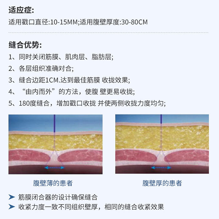 舒擴 一次性使用微創筋膜縫合器